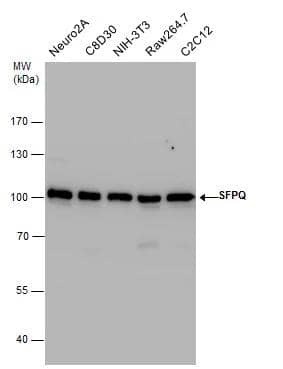 SFPQ antibody detects SFPQ protein by Western blot analysis. Various whole cell extracts (30 ug) were separated by 7.5% SDS-PAGE, and the membrane was blotted with SFPQ antibody (NBP2-20329) diluted by 1:10000. 