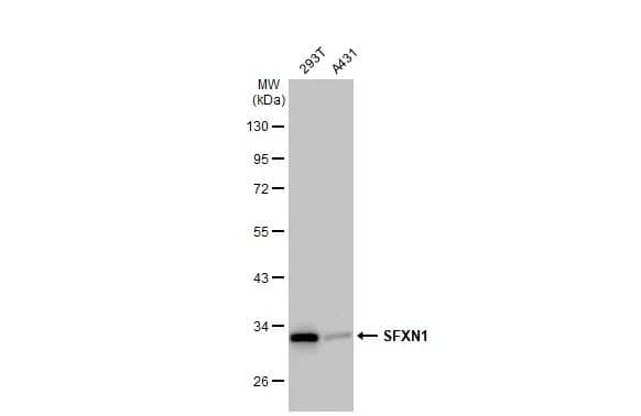 Western Blot: SFXN1 Antibody [NBP2-20333] - Various whole cell extracts (30 ug) were separated by 10% SDS-PAGE, and the membrane was blotted with SFXN1 antibody (NBP2-20333) diluted at 1:1000. The HRP-conjugated anti-rabbit IgG antibody  was used to detect the primary antibody.