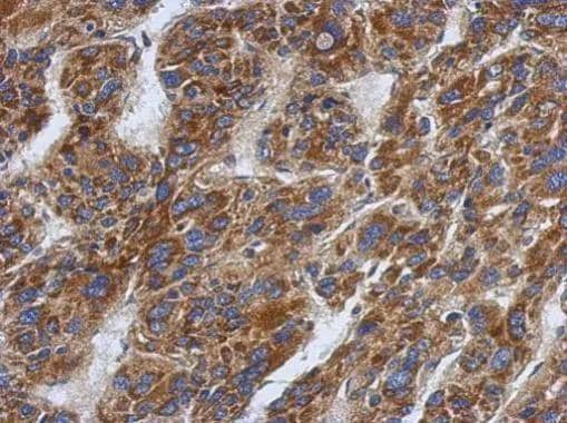 Immunohistochemistry SFXN1 Antibody - BSA Free