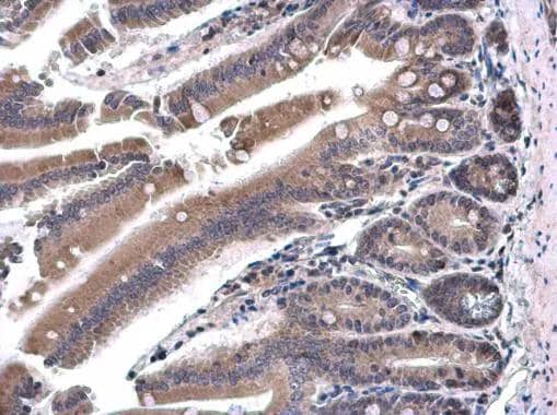 SH3BP1 antibody detects SH3BP1 protein at cytoplasm in mouse duodenum by immunohistochemical analysis. Sample: Paraffin-embedded mouse duodenum. SH3BP1 antibody (NBP2-20342) diluted at 1:500. br>Antigen Retrieval: Citrate buffer, pH 6.0, 15 min 