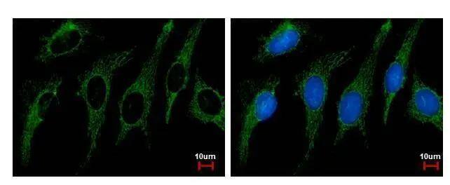 SHMT2 antibody detects SHMT2 protein at Mitochondria by immunofluorescent analysis. Sample: HeLa cells were fixed in ice-cold MeOH for 1 sec.Green: SHMT2 protein stained by SHMT2 antibody (NBP2-20354) diluted at 1:500.Blue: Hoechst 33342 staining. 