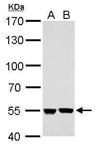 SHMT2 antibody detects SHMT2 protein by Western blot analysis.A. 30 ug A431 whole cell lysate/extractB. 30 ug HepG2 whole cell lysate/extract7.5 % SDS-PAGESHMT2 antibody (NBP2-20354) dilution: 1:5000 