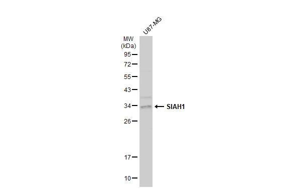 Whole cell extract (30 ug) was separated by 12% SDS-PAGE, and the membrane was blotted with SIAH1 antibody (NBP2-20356) diluted at 1:1000. The HRP-conjugated anti-rabbit IgG antibody  was used to detect the primary antibody. 