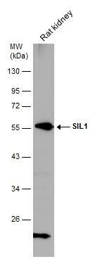 Rat tissue extract (50 ug) was separated by 10% SDS-PAGE, and the membrane was blotted with SIL1 antibody [N1N3] (NBP2-20365) diluted at 1:5000. 