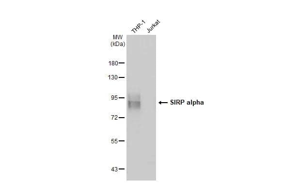 Various whole cell extracts (30 ug) were separated by 7.5% SDS-PAGE, and the membrane was blotted with SIRP alpha antibody (NBP2-20370) diluted at 1:1000. The HRP-conjugated anti-rabbit IgG antibody  was used to detect the primary antibody. 