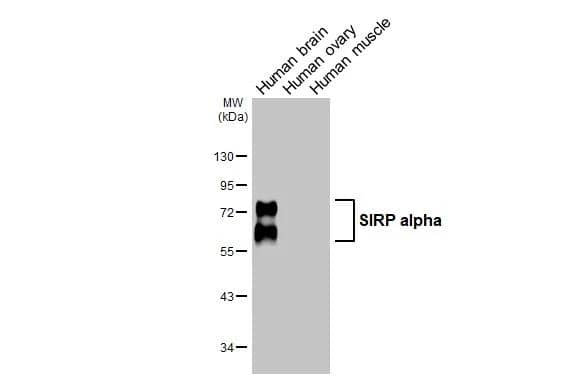 Various tissue extracts (30 ug) were separated by 10% SDS-PAGE, and the membrane was blotted with SIRP alpha antibody (NBP2-20370) diluted at 1:1000. The HRP-conjugated anti-rabbit IgG antibody  was used to detect the primary antibody. 