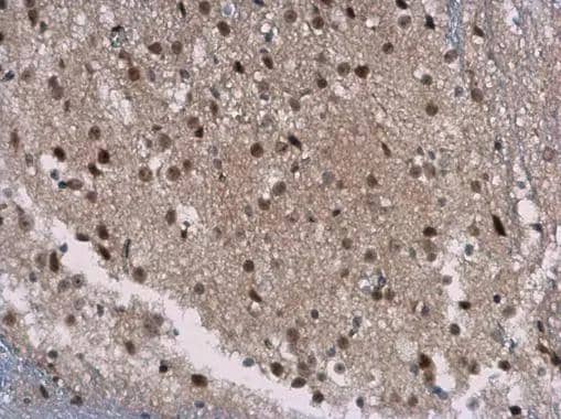 SIRT7 antibody [N2C3] detects SIRT7 protein at cytoplasm and nucleus in mouse brain by immunohistochemical analysis. Sample: Paraffin-embedded mouse brain. SIRT7 antibody [N2C3] (NBP2-20375) diluted at 1:400. br>Antigen Retrieval: Citrate buffer, pH 6.0, 15 min 