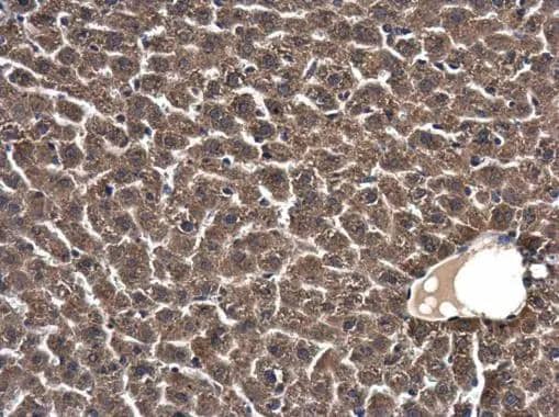 Immunohistochemistry-Paraffin SKA1 Antibody