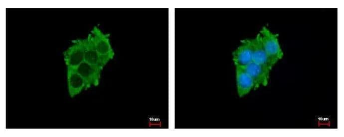 Immunocytochemistry/ Immunofluorescence Sialin/SLC17A5 Antibody - BSA Free