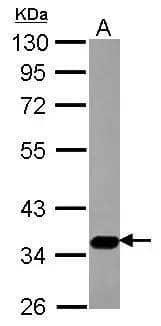 Western Blot Sialin/SLC17A5 Antibody - BSA Free