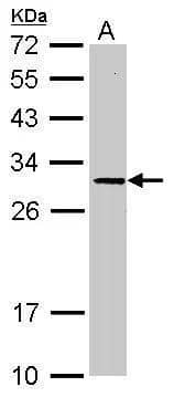 Western Blot SLC25A15 Antibody - BSA Free