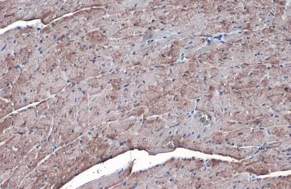 Immunohistochemistry-Paraffin: SLC25A6 Antibody [NBP2-20393] - SLC25A6 antibody detects SLC25A6 protein at mitochondria by immunohistochemical analysis.Sample: Paraffin-embedded mouse heart.SLC25A6 stained by SLC25A6 antibody (NBP2-20393) diluted at 1:1000.Antigen Retrieval: Citrate buffer, pH 6.0, 15 min