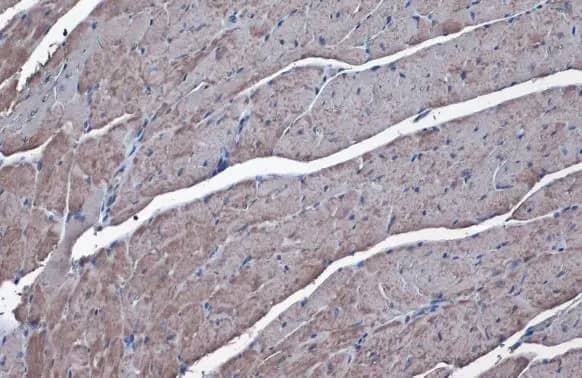 Immunohistochemistry-Paraffin: SLC25A6 Antibody [NBP2-20393] - SLC25A6 antibody detects SLC25A6 protein at mitochondria by immunohistochemical analysis.Sample: Paraffin-embedded mouse heart.SLC25A6 stained by SLC25A6 antibody (NBP2-20393) diluted at 1:1000.Antigen Retrieval: Citrate buffer, pH 6.0, 15 min