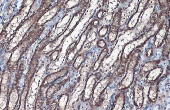 Immunohistochemistry-Paraffin: SLC25A6 Antibody [NBP2-20393] - SLC25A6 antibody detects SLC25A6 protein at mitochondria by immunohistochemical analysis.Sample: Paraffin-embedded rat kidney.SLC25A6 stained by SLC25A6 antibody (NBP2-20393) diluted at 1:1000.Antigen Retrieval: Citrate buffer, pH 6.0, 15 min