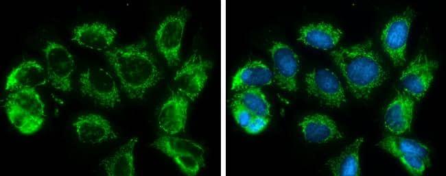 SLC25A6 antibody detects SLC25A6 protein at mitochondria by immunofluorescent analysis.Sample: MCF7 cells were fixed in 4% paraformaldehyde at RT for 15 min.Green: SLC25A6 protein stained by SLC25A6 antibody (NBP2-20393) diluted at 1:500.Blue: Hoechst 33342 staining. 