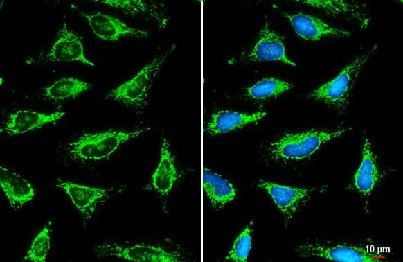 SLC25A6 antibody detects SLC25A6 protein at mitochondria by immunofluorescent analysis.Sample: HeLa cells were fixed in ice-cold MeOH for 5 min.Green: SLC25A6 stained by SLC25A6 antibody (NBP2-20393) diluted at 1:500.Blue: Fluoroshield with DAPI .Scale bar= 10 um. 