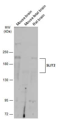 Western Blot: Slit2 Antibody [NBP2-20398] - Various tissue extracts (50 ug) were separated by 5% SDS-PAGE, and the membrane was blotted with Slit2 antibody (NBP2-20398) diluted at 1:1000. The HRP-conjugated anti-rabbit IgG antibody  was used to detect the primary antibody.