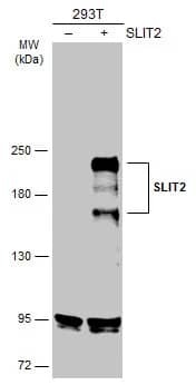 Western Blot: Slit2 Antibody [NBP2-20398] - Non-transfected (-) and transfected (+) 293T whole cell extracts (50 ug) were separated by 5% SDS-PAGE, and the membrane was blotted with Slit2 antibody (NBP2-20398) diluted at 1:2000. The HRP-conjugated anti-rabbit IgG antibody  was used to detect the primary antibody.