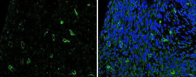 SLIT2 antibody detects SLIT2 protein at cytoplasm in mouse fetal brain by immunohistochemical analysis.Sample: Paraffin-embedded mouse fetal brain. Green: SLIT2 antibody (NBP2-20398) diluted at 1:200. The signal was developed using goat anti-rabbit IgG antibody (Dylight488) .Blue: Nuclear staining with Hoechst 33342. br>Antigen Retrieval: Citrate buffer, pH 6.0, 15 min 