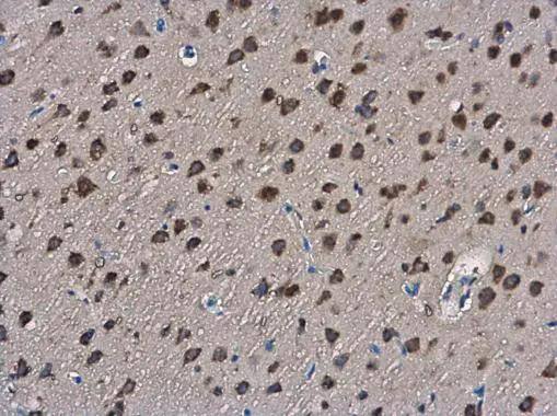 SLIT2 antibody detects SLIT2 protein at cytoplasm in rat brain by immunohistochemical analysis. Sample: Paraffin-embedded rat brain. SLIT2 antibody (NBP2-20398) diluted at 1:400. br>Antigen Retrieval: Citrate buffer, pH 6.0, 15 min 