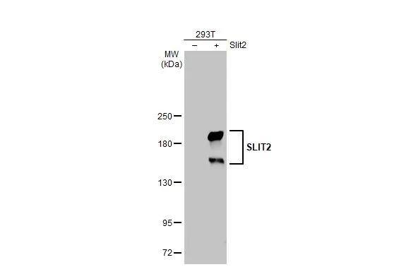 Non-transfected (-) and transfected (+) 293T whole cell extracts (30 ug) were separated by 5% SDS-PAGE, and the membrane was blotted with SLIT2 antibody (NBP2-20398) diluted at 1:2000. The HRP-conjugated anti-rabbit IgG antibody  was used to detect the primary antibody. 