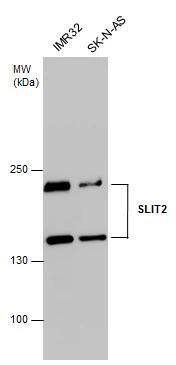 SLIT2 antibody detects SLIT2 protein by western blot analysis. Various whole cell extracts (30 ug) were separated by 5% SDS-PAGE, and the membrane was blotted with SLIT2 antibody (NBP2-20398) diluted at 1:1000. The HRP-conjugated anti-rabbit IgG antibody  was used to detect the primary antibody. 