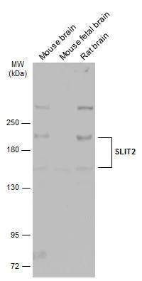 Various tissue extracts (50 ug) were separated by 5% SDS-PAGE, and the membrane was blotted with SLIT2 antibody (NBP2-20398) diluted at 1:1000. The HRP-conjugated anti-rabbit IgG antibody  was used to detect the primary antibody. 