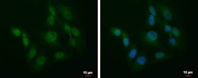 Immunocytochemistry/ Immunofluorescence SLU7 Antibody - BSA Free