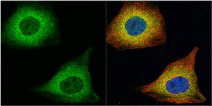 Transgelin antibody detects Transgelin protein at cytoplasm by immunofluorescent analysis.Sample: HeLa cells were fixed in 4% paraformaldehyde at RT for 15 min.Green: Transgelin protein stained by Transgelin antibody (NBP2-20405) diluted at 1:100.Red: alpha Tubulin, a cytoskeleton marker, stained by alpha Tubulin antibody [GT114]  diluted at 1:500.Blue: Hoechst 33342 staining. 