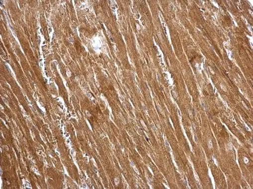 Transgelin antibody detects Transgelin protein at cytosol on mouse heart by immunohistochemical analysis. Sample: Paraffin-embedded mouse heart. Transgelin antibody (NBP2-20405) dilution: 1:500. Antigen Retrieval: Trilogy(TM) (EDTA based, pH 8.0) buffer, 15min 