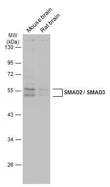 Various tissue extracts (50 ug) were separated by 10% SDS-PAGE, and the membrane was blotted with SMAD2 / SMAD3 antibody (NBP2-20411) diluted at 1:5000. The HRP-conjugated anti-rabbit IgG antibody  was used to detect the primary antibody. 