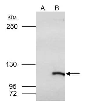 Immunoprecipitation SmarcAL1 Antibody - BSA Free