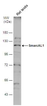 Rat tissue extract (50 ug) was separated by 7.5% SDS-PAGE, and the membrane was blotted with SmarcAL1 antibody (NBP2-20414) diluted at 1:500. The HRP-conjugated anti-rabbit IgG antibody  was used to detect the primary antibody. 