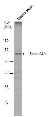 Western Blot SmarcAL1 Antibody - BSA Free