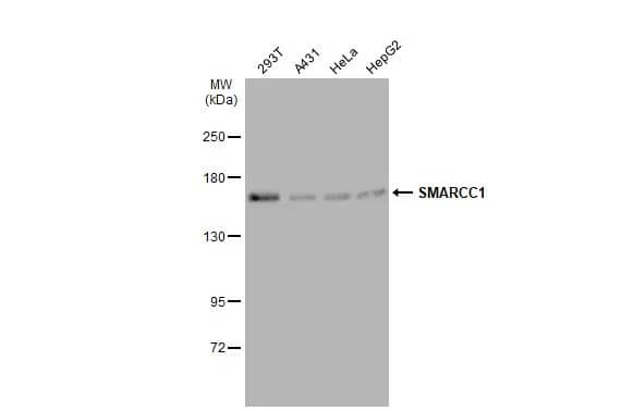 Western Blot: SMARCC1 Antibody [NBP2-20415] - Various whole cell extracts (30 ug) were separated by 5% SDS-PAGE, and the membrane was blotted with SMARCC1 antibody [C2C3], C-term (NBP2-20415) diluted at 1:2000. The HRP-conjugated anti-rabbit IgG antibody  was used to detect the primary antibody.