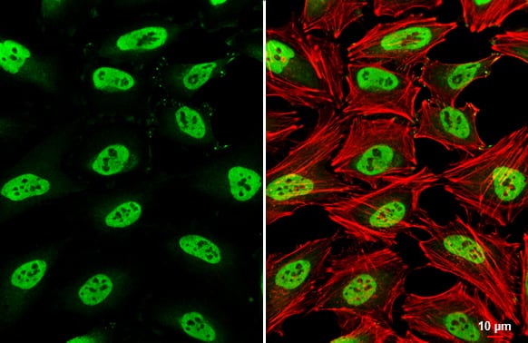 Immunocytochemistry/ Immunofluorescence: SMARCC1 Antibody [NBP2-20415] - SMARCC1 antibody [C2C3], C-term detects SMARCC1 protein at nucleus by immunofluorescent analysis.Sample: HeLa cells were fixed in 4% paraformaldehyde at RT for 15 min.Green: SMARCC1 stained by SMARCC1 antibody [C2C3], C-term (NBP2-20415) diluted at 1:500.Red: phalloidin, a cytoskeleton marker, diluted at 1:200.Scale bar= 10 um.