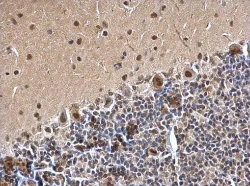 SMARCC1 antibody [C2C3], C-term detects SMARCC1 protein at nucleus on rat hind brain by immunohistochemical analysis. Sample: Paraffin-embedded rat hind brain. SMARCC1 antibody [C2C3], C-term (NBP2-20415) dilution: 1:500. br>Antigen Retrieval: Trilogy(TM) (EDTA based, pH 8.0) buffer, 15min 