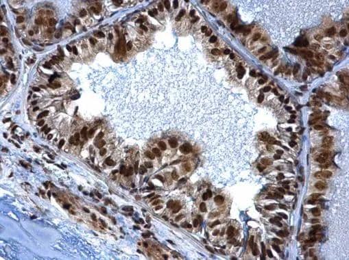 SMARCC1 antibody [C2C3], C-term detects SMARCC1 protein at nucleus on mouse prostate by immunohistochemical analysis. Sample: Paraffin-embedded mouse prostate. SMARCC1 antibody [C2C3], C-term (NBP2-20415) dilution: 1:500. Antigen Retrieval: Trilogy(TM) (EDTA based, pH 8.0) buffer, 15min 