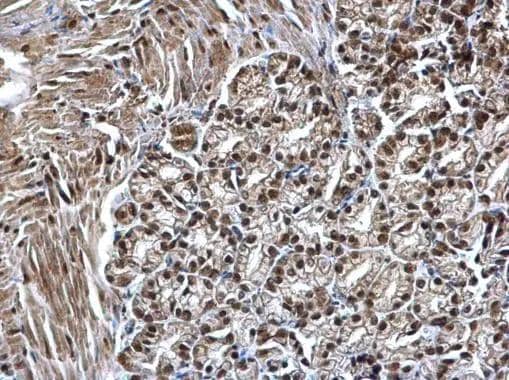 SMARCC1 antibody [C2C3], C-term detects SMARCC1 protein at nucleus on mouse duodenum by immunohistochemical analysis. Sample: Paraffin-embedded mouse duodenum. SMARCC1 antibody [C2C3], C-term (NBP2-20415) dilution: 1:500. br>Antigen Retrieval: Trilogy(TM) (EDTA based, pH 8.0) buffer, 15min 