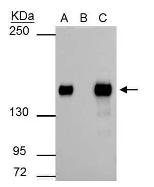 SMARCC1 antibody immunoprecipitates SMARCC1 protein in IP experiments. IP Sample: 293T whole cell lysate/extract A : 30 ug whole cell lysate/extract of SMARCC1 protein expressing 293T cells B : Control with 2.5 ug of pre-immune rabbit IgG C : Immunoprecipitation of SMARCC1 by 2.5 ug of SMARCC1 antibody (NBP2-20415) 5% SDS-PAGE The immunoprecipitated SMARCC1 protein was detected by SMARCC1 antibody (NBP2-20415) diluted at 1 : 1000. EasyBlot anti-rabbit IgG (HRP)  was used as a secondary reagent. 