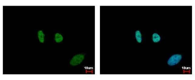 Immunocytochemistry/ Immunofluorescence SMC6L1 Antibody