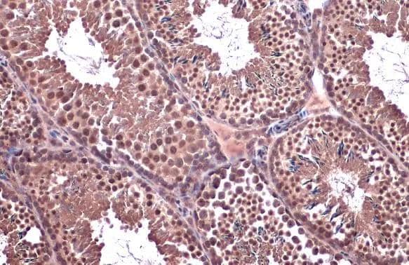Immunohistochemistry-Paraffin SMC6L1 Antibody