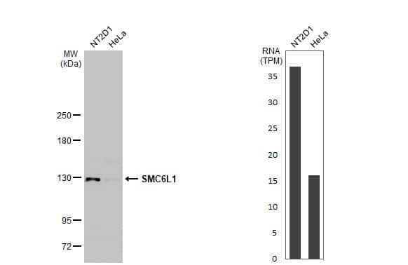 Western Blot SMC6L1 Antibody