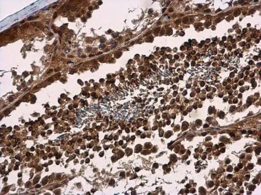 Immunohistochemistry-Paraffin SMG7 Antibody