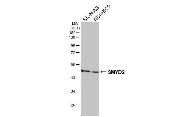 Western Blot SMYD2 Antibody - BSA Free