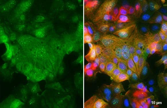 SMYD3 antibody detects SMYD3 protein by immunofluorescent analysis.Sample: MCF-7 cells were fixed in 4% paraformaldehyde at RT for 15 min.Green: SMYD3 stained by SMYD3 antibody (NBP2-20430) diluted at 1:500.Red: alpha Tubulin, a cytoskeleton marker, stained by alpha Tubulin antibody [GT114]  diluted at 1:1000.Blue: Fluoroshield with DAPI . 