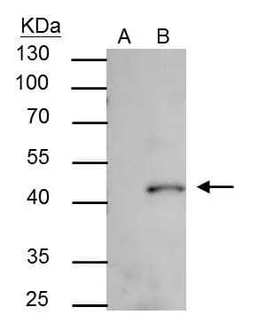 SMYD3 antibody immunoprecipitates SMYD3 protein in IP experiments. IP Sample: 293T whole cell lysate/extract A : Control with 2.5 ug of pre-immune rabbit IgG B : Immunoprecipitation of SMYD3 by 2.5 ug of SMYD3 antibody (NBP2-20432) 10% SDS-PAGE The immunoprecipitated SMYD3 protein was detected by SMYD3 antibody (NBP2-20432) diluted at 1 : 1000. EasyBlot anti-rabbit IgG (HRP)  was used as a secondary reagent. 