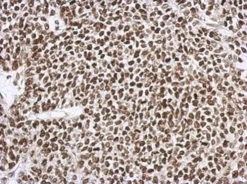 Immunohistochemical analysis of paraffin-embedded 59T xenograft, using SNIP1(NBP2-20437) antibody at 1:500 dilution. br>Antigen Retrieval: Trilogy(TM) (EDTA based, pH 8.0) buffer, 15min 