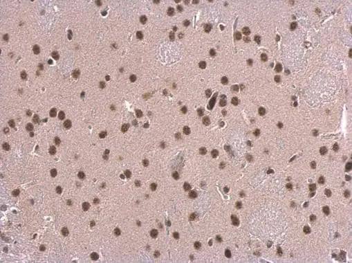 SNRPD2 antibody detects SNRPD2 protein at nucleus on mouse fore brain by immunohistochemical analysis. Sample: Paraffin-embedded mouse fore brain. SNRPD2 antibody (NBP2-20438) dilution: 1:500.Antigen Retrieval: Trilogy(TM) (EDTA based, pH 8.0) buffer, 15min 
