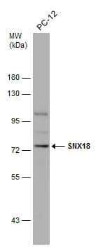 Whole cell extract (30 ug) was separated by 7.5% SDS-PAGE, and the membrane was blotted with SNX18 antibody (NBP2-20443) diluted at 1:1000. 